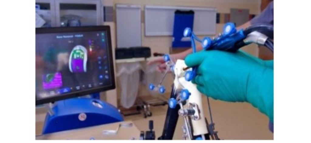 Chirurgia protesica e robotica del ginocchio
